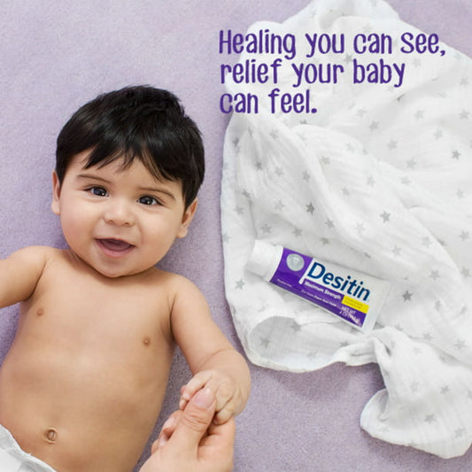 Crema de bebé 3 en 1 Aquaphor para dermatitis del pañal - 3.5 Oz Tubo –  tienditadelu